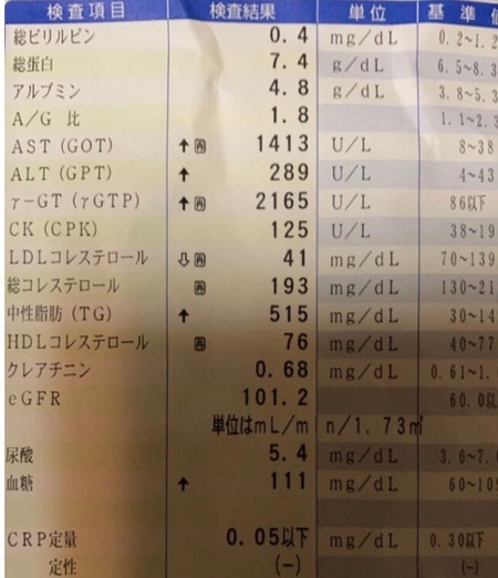 5年間毎日ビール飲み続けた結果wwww