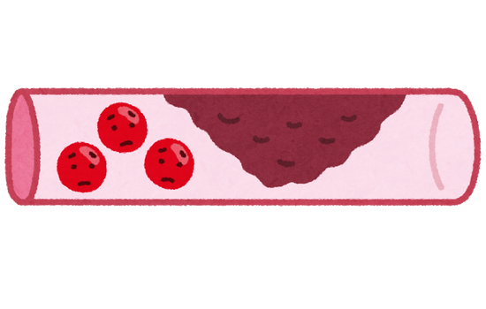 【これマジ？】大動脈瘤に母乳の成分が効くことが判明ｷﾀ━━━━(ﾟ∀ﾟ)━━━━!!