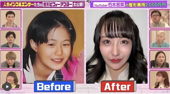 【画像】現代の整形、ここまで綺麗になるｗｗｗ
