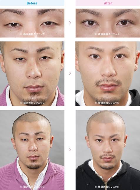 【画像】男の美容整形、夢がありすぎるｗｗｗｗｗ