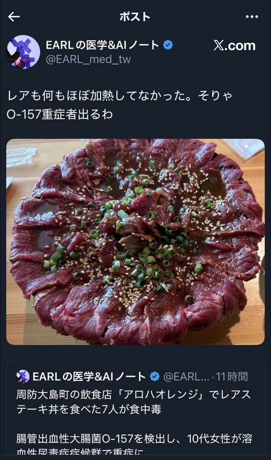 【画像】レアステーキ丼を食べた10代女性重症へ・・・・・