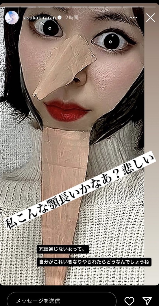 【画像】明日花キララさん、ちくわの毛穴ドアップ写真をインスタに投稿ｗｗｗｗｗ
