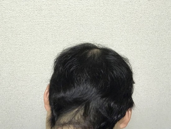 画像 1000円カットにいったらとんでもない頭にされた 2ch ニュー速クオリティ 画像 1000円カットにいったらとんでもない頭にされた 2ch ニュー速クオリティ