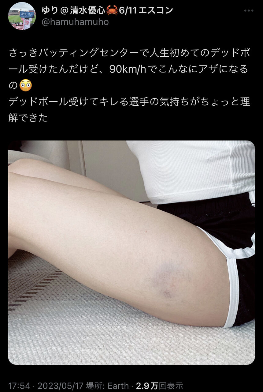 【画像】女の子「デッドボールは90キロでも痛いんだよ？」????