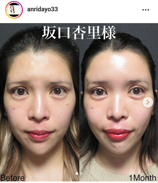 【画像】 坂口杏里さん、整形して絶世の美女に生まれ変わる