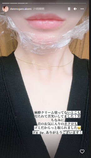 ダレノガレ明美、韓国でお気に入りのホクロを“ゴミ”だと除去されてしまう　