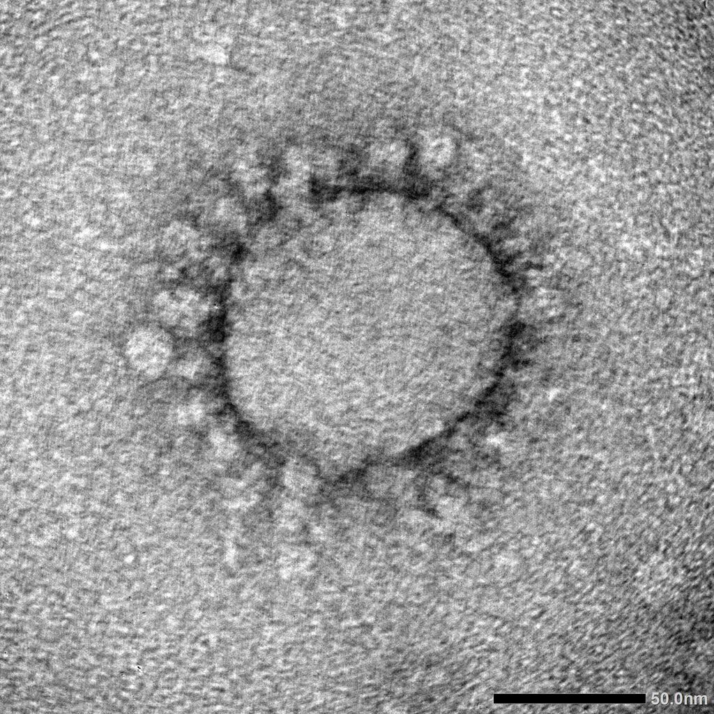 【東京都】新たに33人感染確認　先週日曜日比20人増