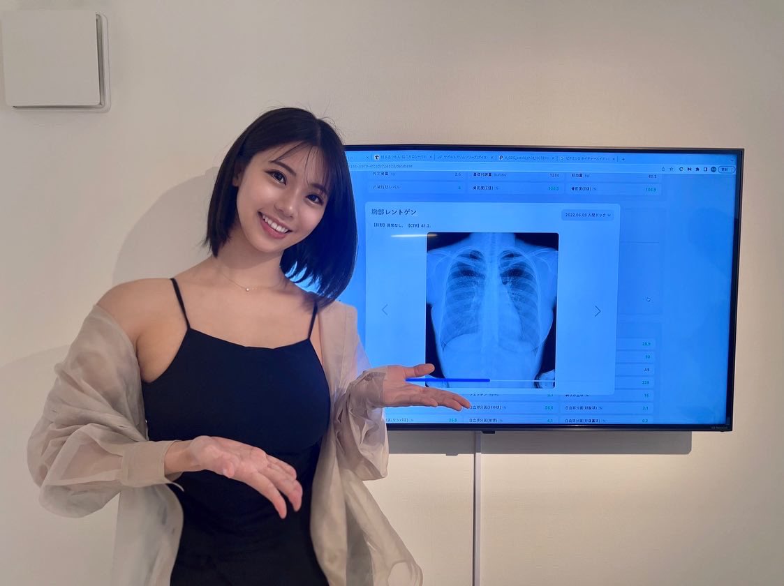 【芸能】バスト９６センチ　鈴木ふみ奈が胸部レントゲン写真を投稿