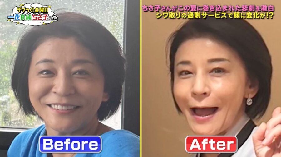 【芸能】の高嶋ちさ子（54）真実告白　韓国での美容施術失敗…