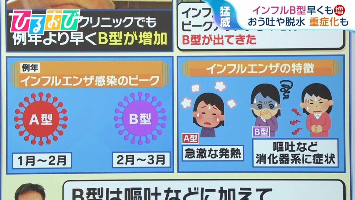 急増するインフルエンザB型：消化器系症状に要注意