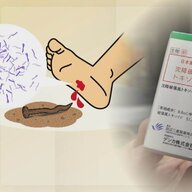 破傷風ワクチン出荷停止：医師が警告する理由とは？