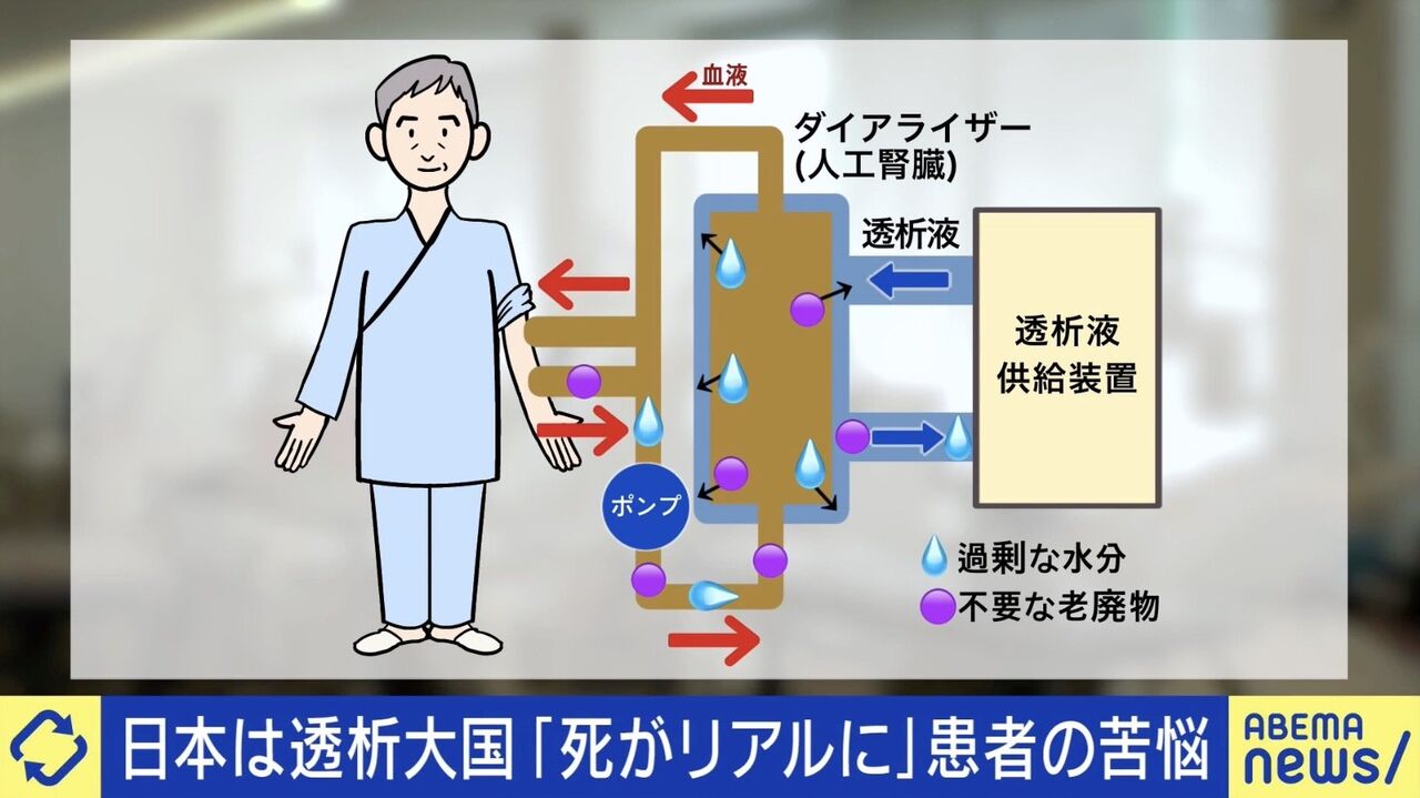 命をつなぐ透析治療と献血に関する誤解の真実