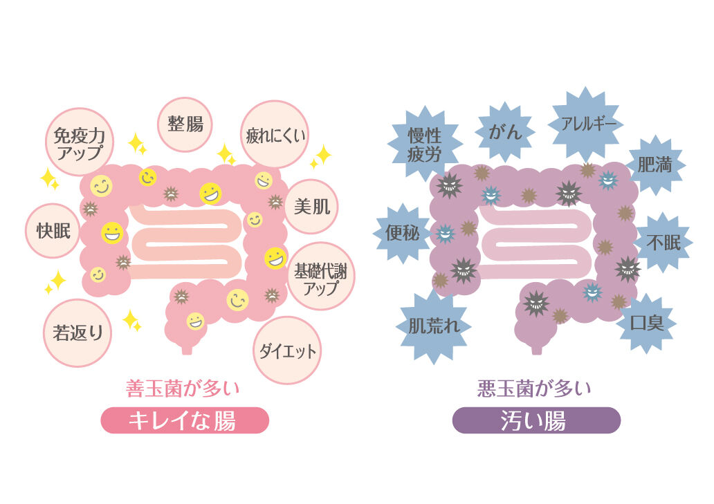 腸を整えて痩せ体質にも美肌にも近づける！雑誌でも紹　お医者さんが教える【腸活】のメリット