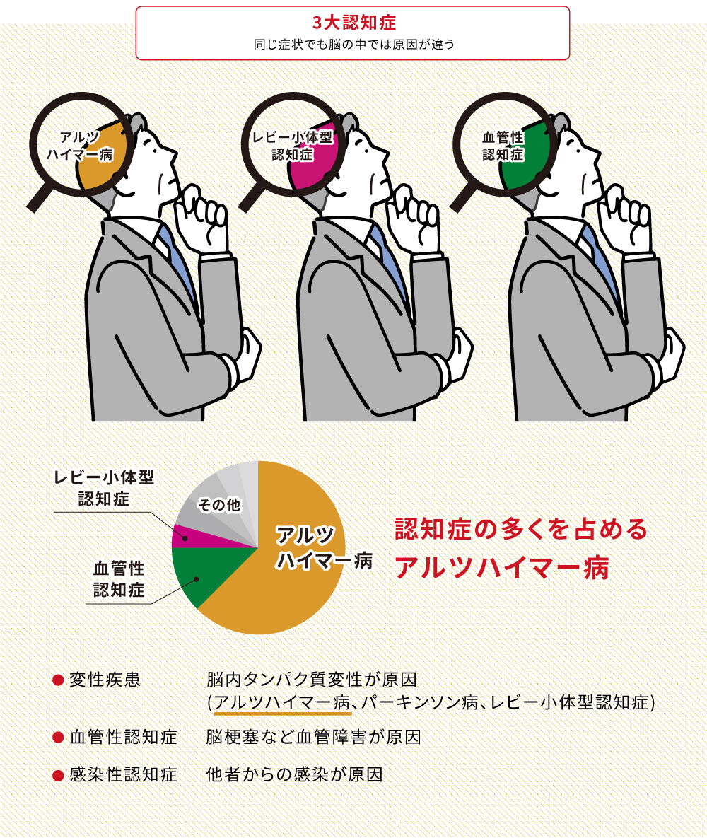 アルツハイマー病の腸内細菌で記憶力低下　若くてもおこる可能性　認知症大国の日本で分かりたい知識とは？