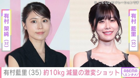 有村藍里 整形