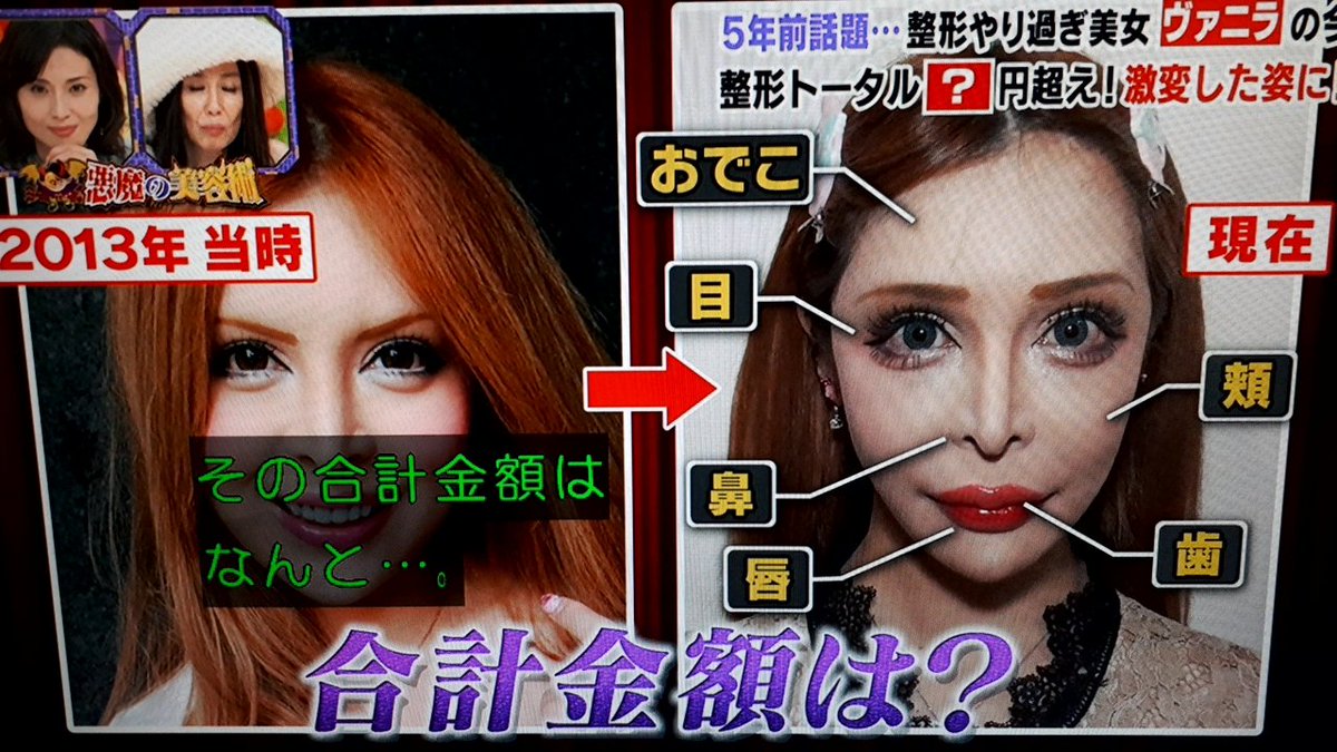 ヴァニラ 整形サイボーグ美女 ヴァニラ 整形総額2億円超えを告白 息が吸いにくくなった ニューストゥデイ ヴァニラ 整形サイボーグ美女 ヴァニラ 整形総額2億円超えを告白 息が吸いにくくなった ニューストゥデイ
