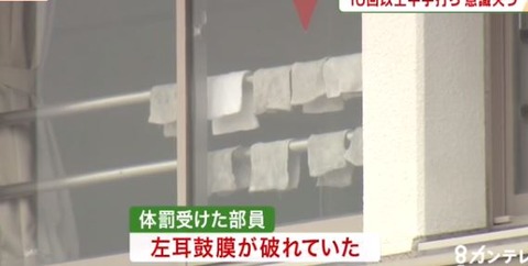 キャプチャ