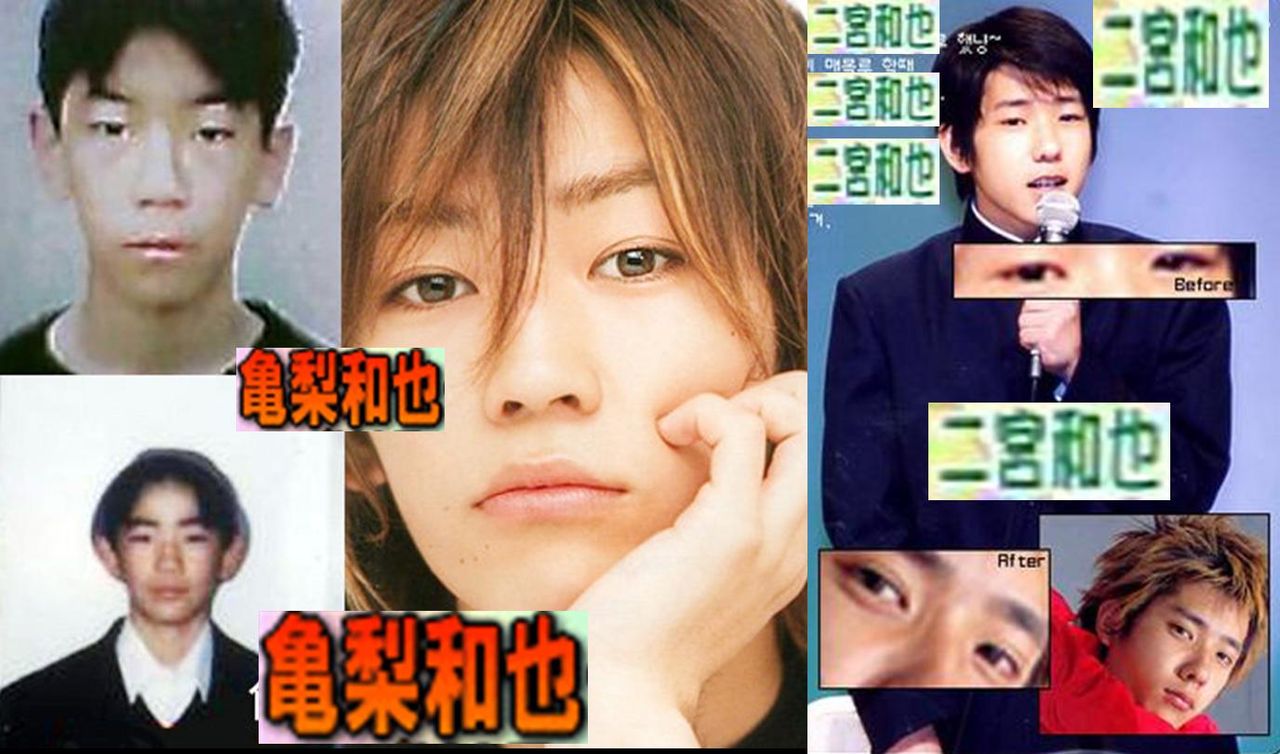 なでしこジャパン沢穂希の美容整形予想写真 見えない障害と闘いながら なでしこジャパン沢穂希の美容整形予想写真 見えない障害と闘いながら
