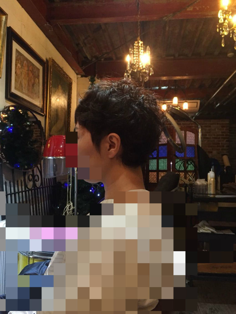 抗がん剤最終投与から9ヵ月目の発毛状況 脱ウィッグ Lasting Blue