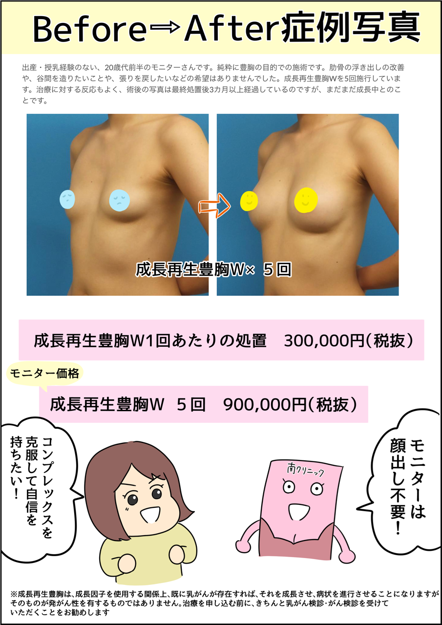 切らない 入れない成長再生豊胸wで 周りにバレずにこっそり豊胸 Pr 施術画像があるので閲覧時は注意 人間まおと愉快な仲間たち Powered By ライブドアブログ