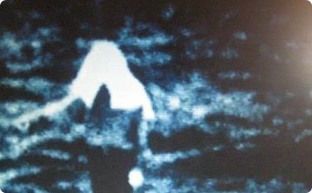 リング【ゾッとする話】異様な光景-不気味