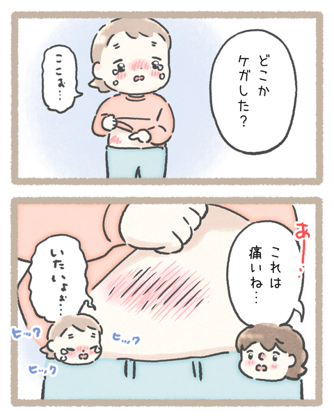 2 育児251112ケガ色_20251114100134