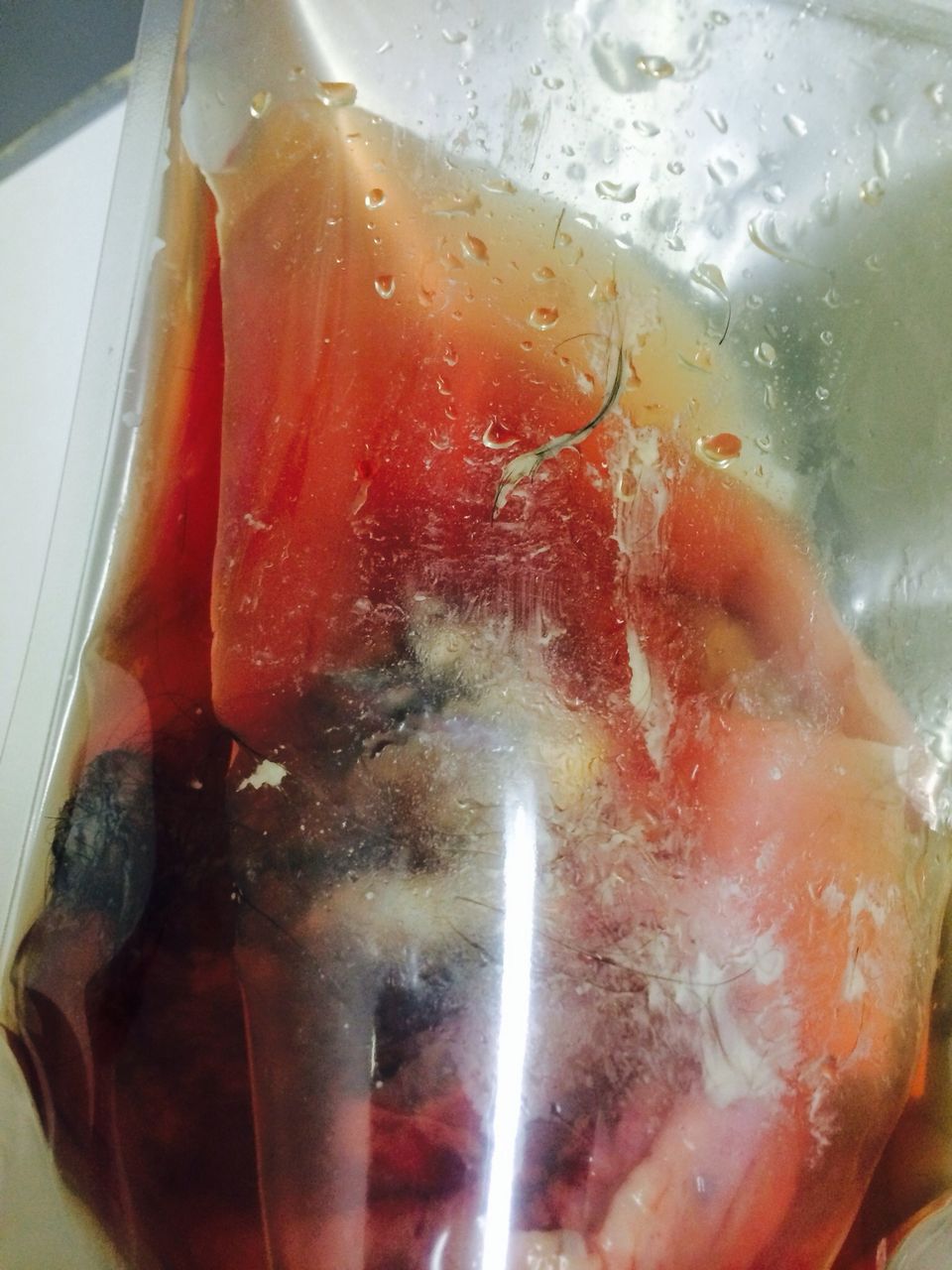髪の毛と骨と歯が入った腫瘍出来たwww たこやき速報