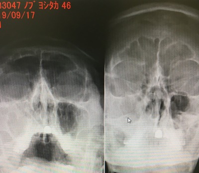 2019_101