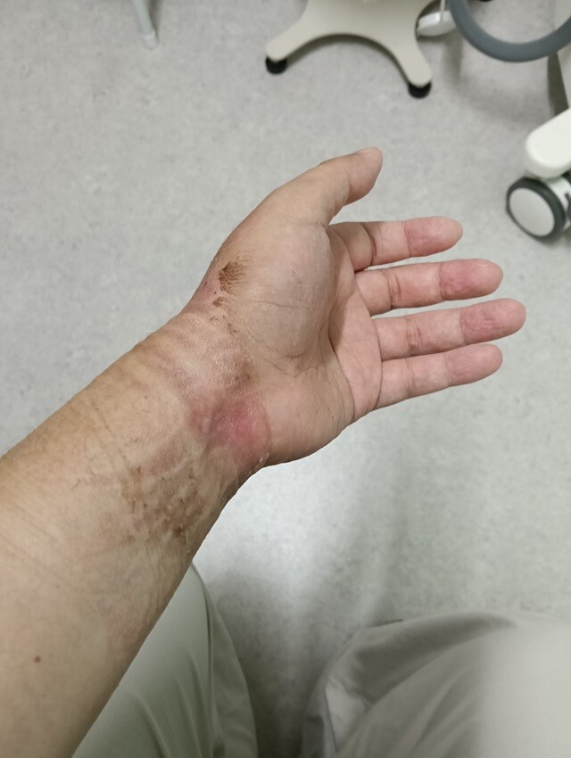 IMG20260713085942_640
