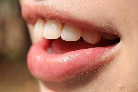 mouth-2791895__480