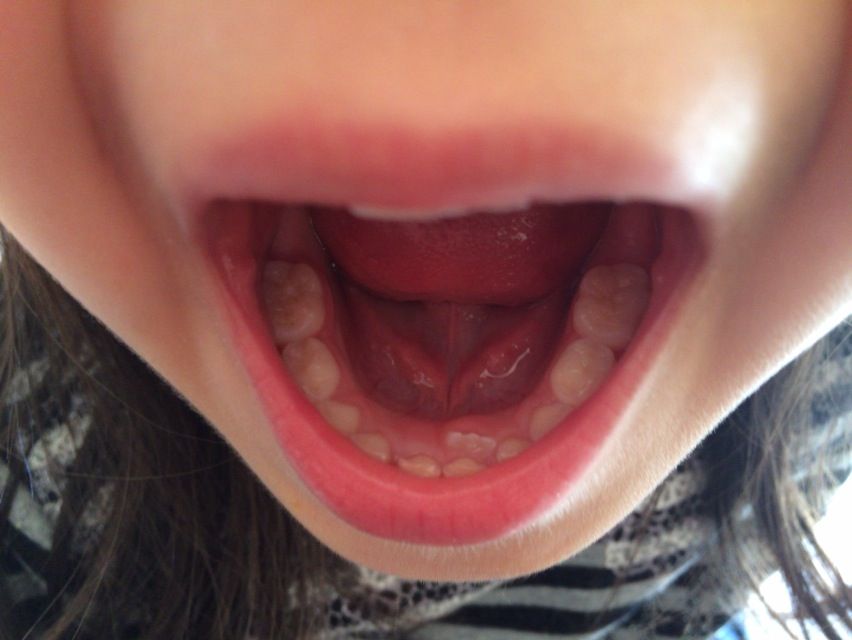 はなちゃんに歯が生えた しあわせの歌をうたおう