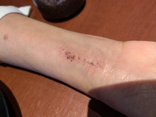 PXL_20241011_033203356