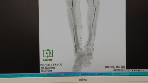 DSC_0001_BURST20200702160133372