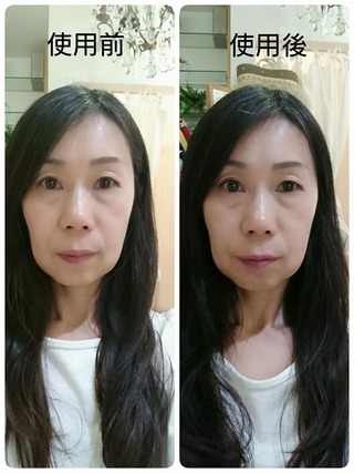 34014194_1336023243209362_8025193065985605632_n