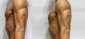 2024-2025（二頭筋の比較）-side