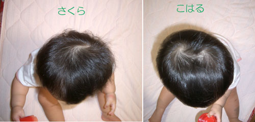 頭の形 のりパパのブログ