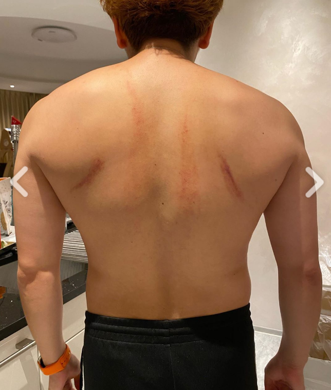 どうしたヒカキンｗ激太り ８０キロ超になんだか心配です 月光の囁き