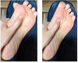 拇指球