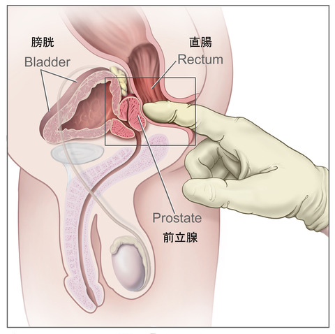 前立腺の場所