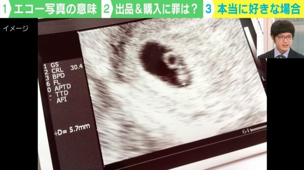 【闇深】「すんげぇの売られてた」 女性が妊娠時に撮影する“胎児のエコー写真”がフリマサイトに出品…一体、誰がなんのために使うのか？