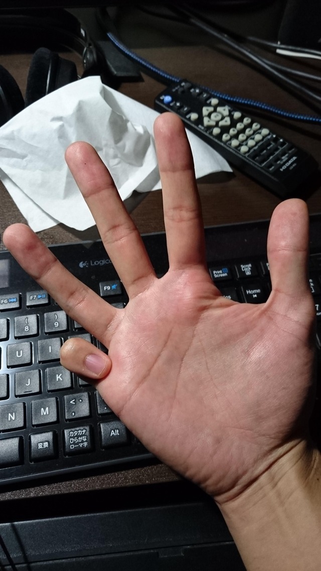 no title