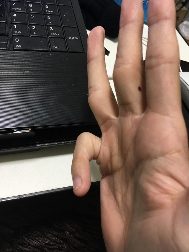 no title