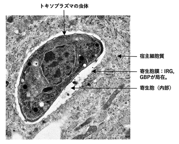 【恐怖！】金持ちや成功者は実は寄生虫に脳を支配されている可能性が大だという研究結果