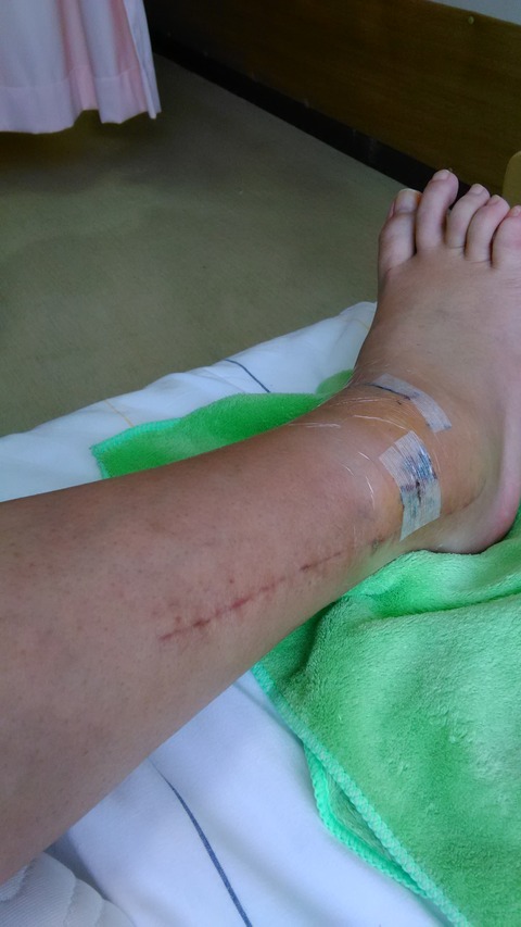 P_20200302_091114_BF