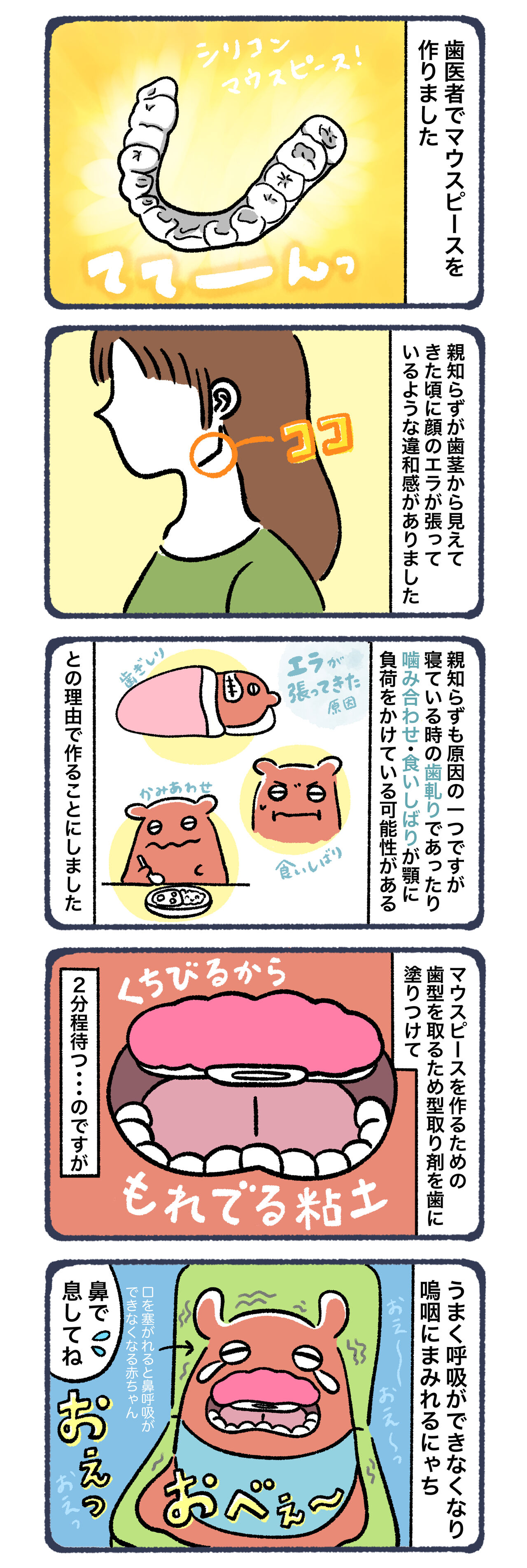 マウスピース作ってもろた にゃちさん家