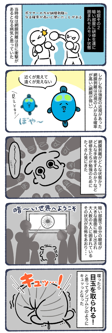 網膜剥離になってコンタクトをする話3