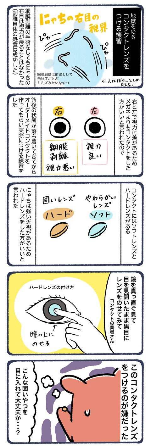 網膜剥離になってコンタクトをする話7