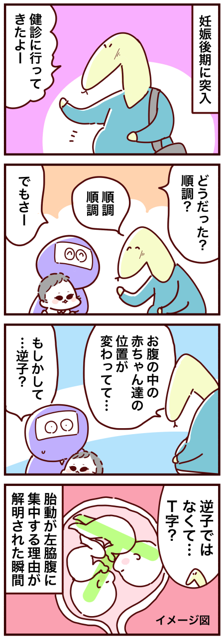 双子後期のお腹ポジション 双子妊娠記録40 おばバカ日誌 Powered By ライブドアブログ