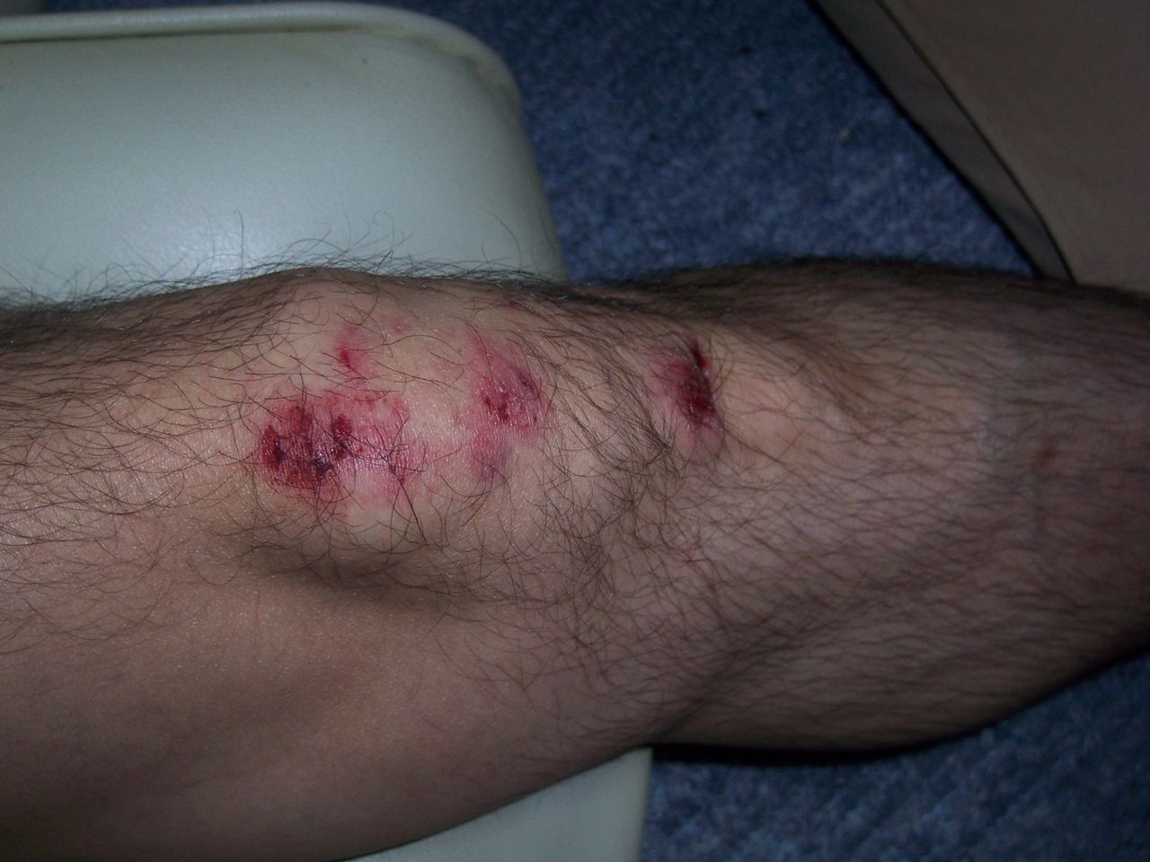 やっちまいました 転倒 バイクと日々の戯言 Crf1000lアフリカツイン やっちまいました 転倒 バイクと日々の戯言 Crf1000lアフリカツイン