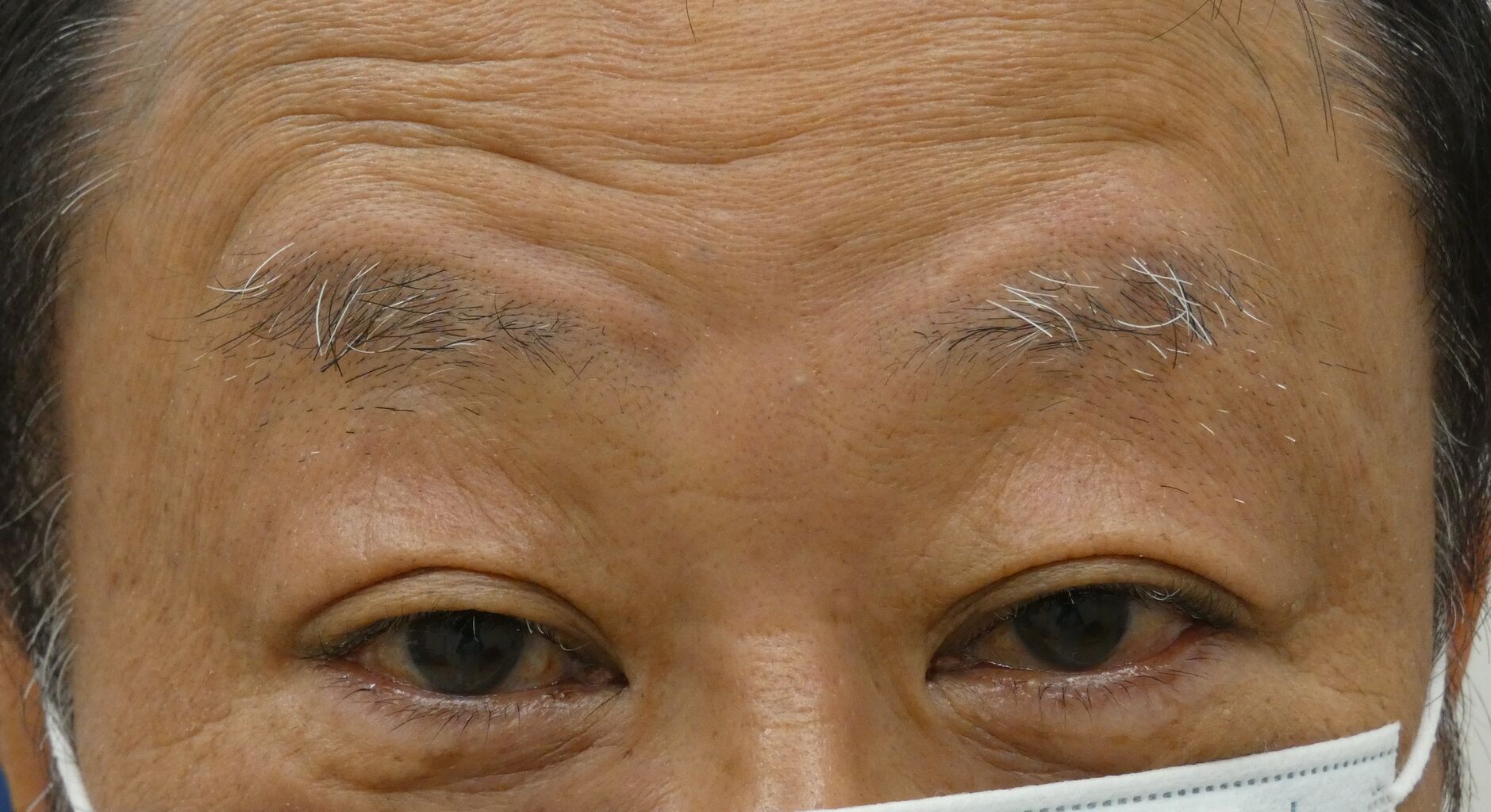 男性のアートメイク 眼瞼下垂とアートメイクの緒方眼科クリニック 大田区蒲田駅近く 男性のアートメイク 眼瞼下垂とアートメイクの緒方眼科クリニック 大田区蒲田駅近く